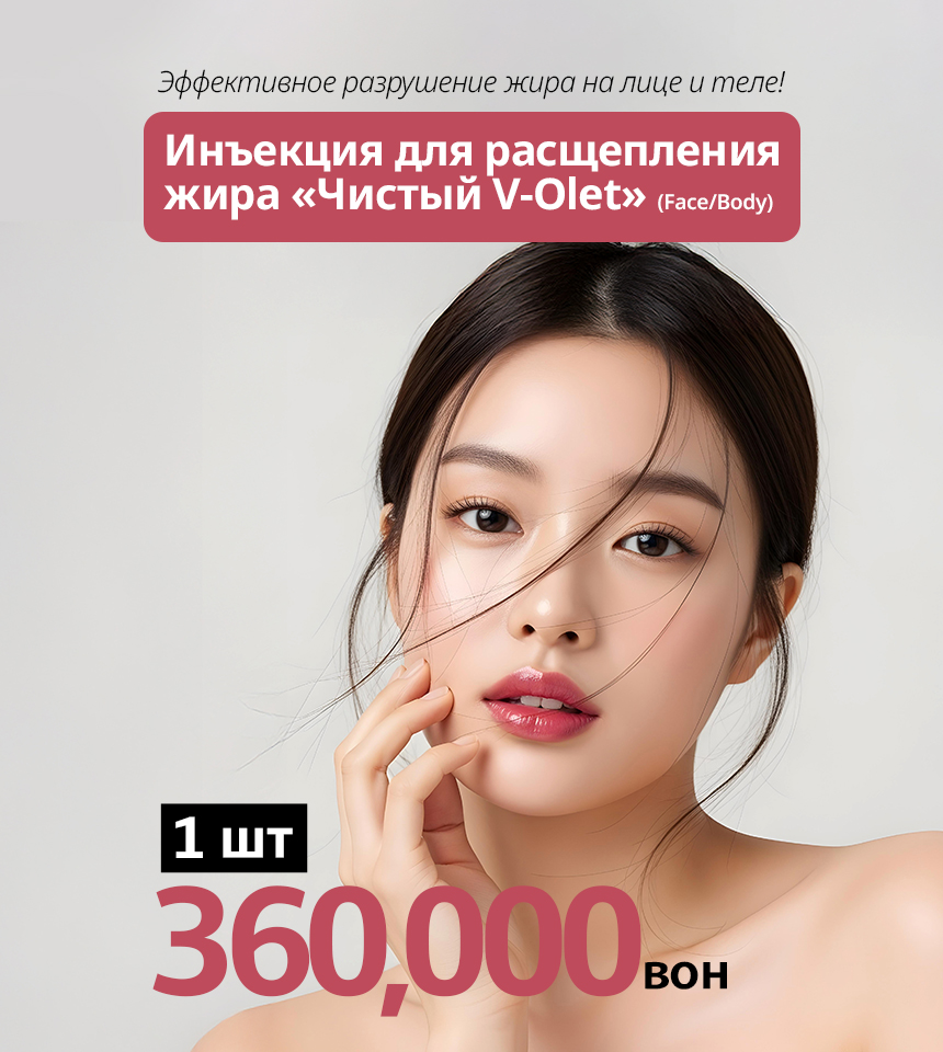 Рекламный баннер