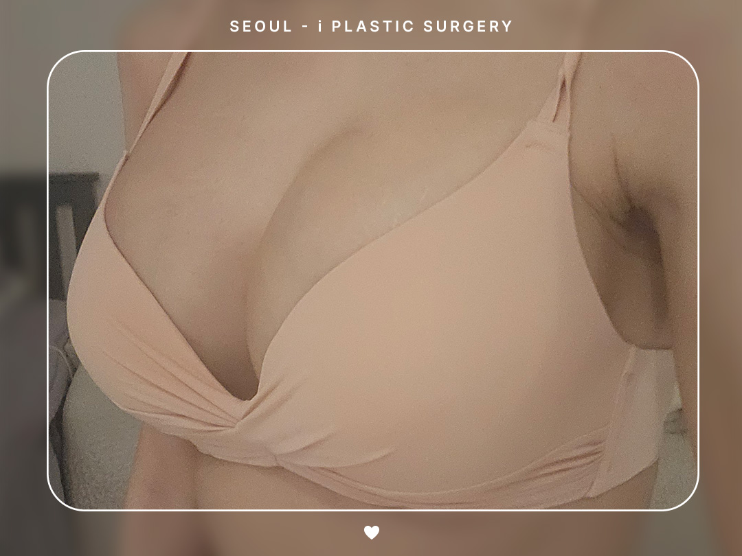 리얼셀카이미지