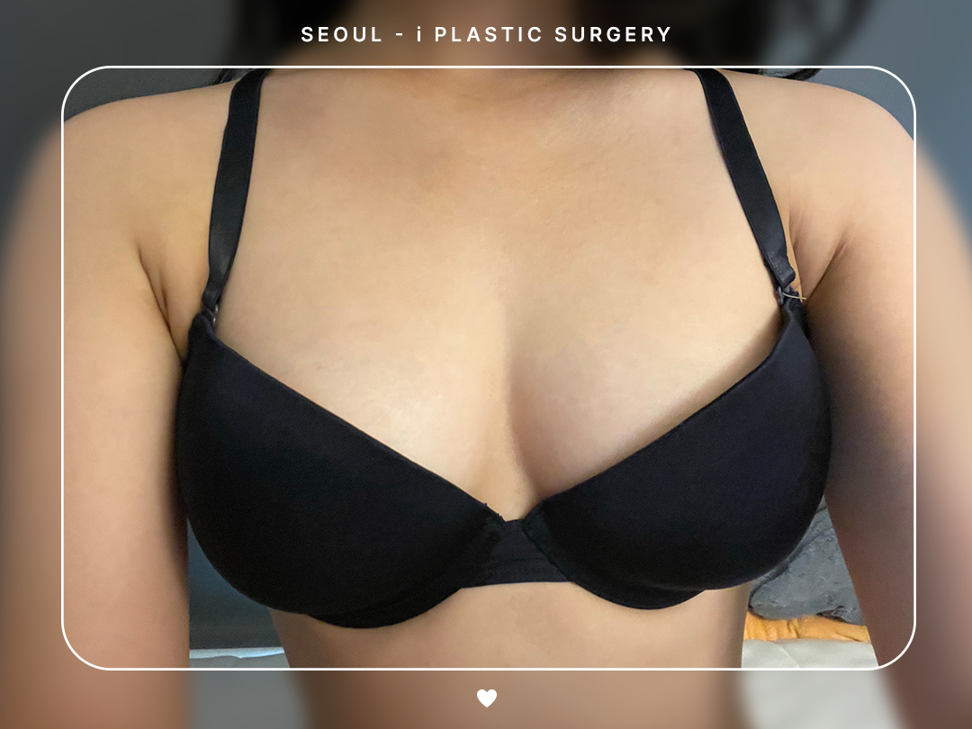 리얼셀카이미지