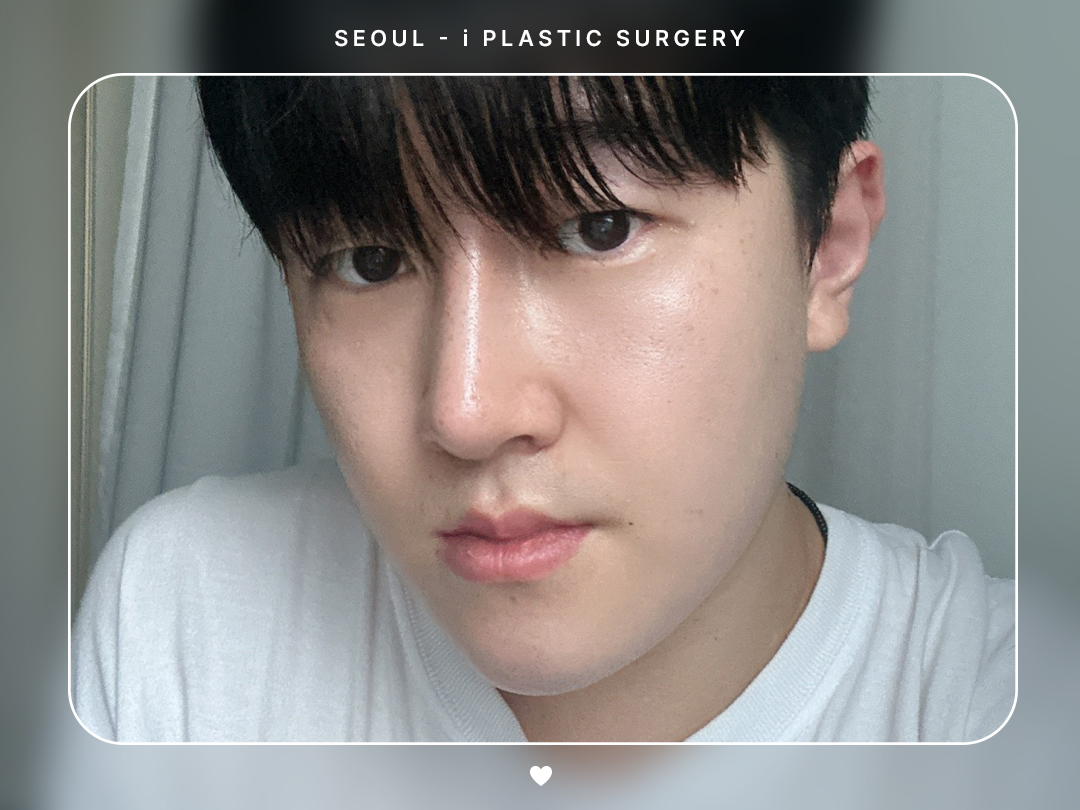 리얼셀카이미지