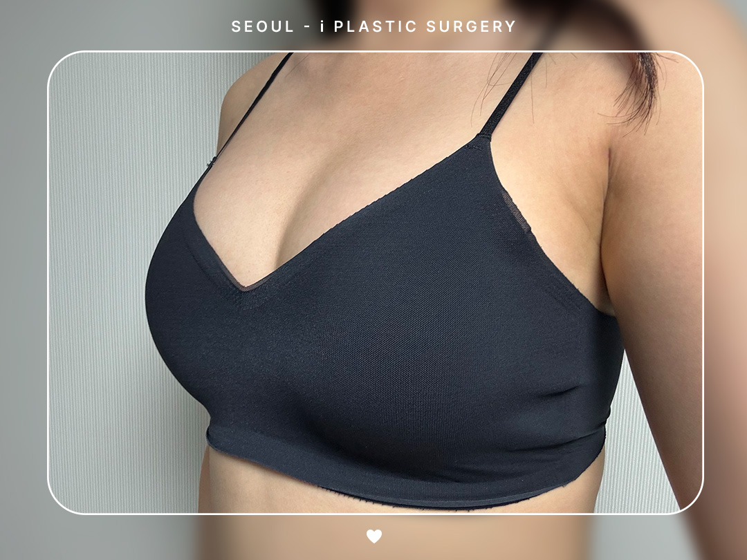 리얼셀카이미지