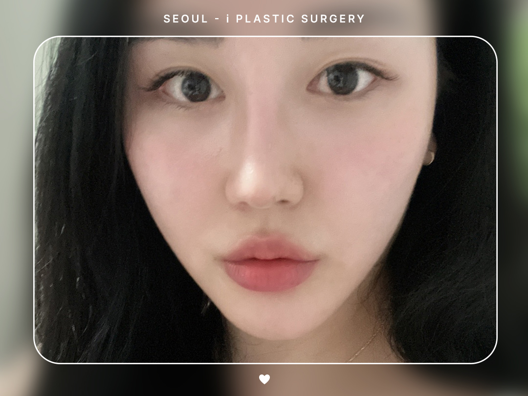 리얼셀카이미지