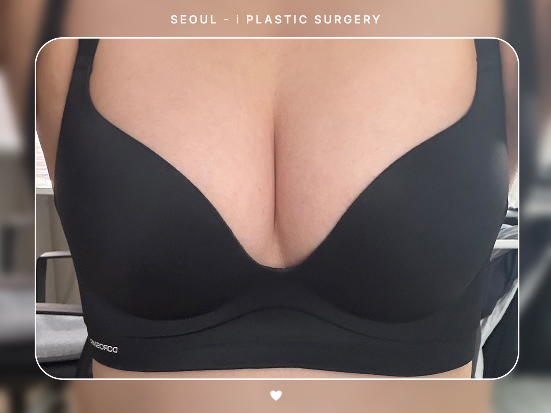 리얼셀카이미지