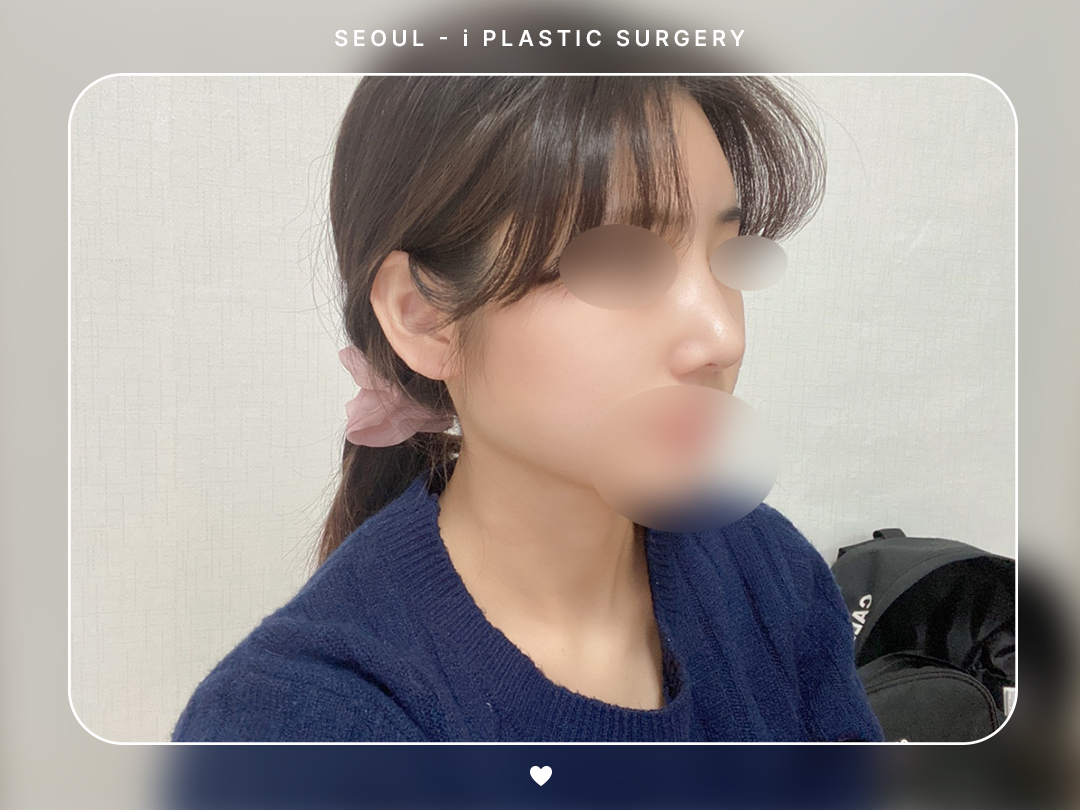 리얼셀카이미지
