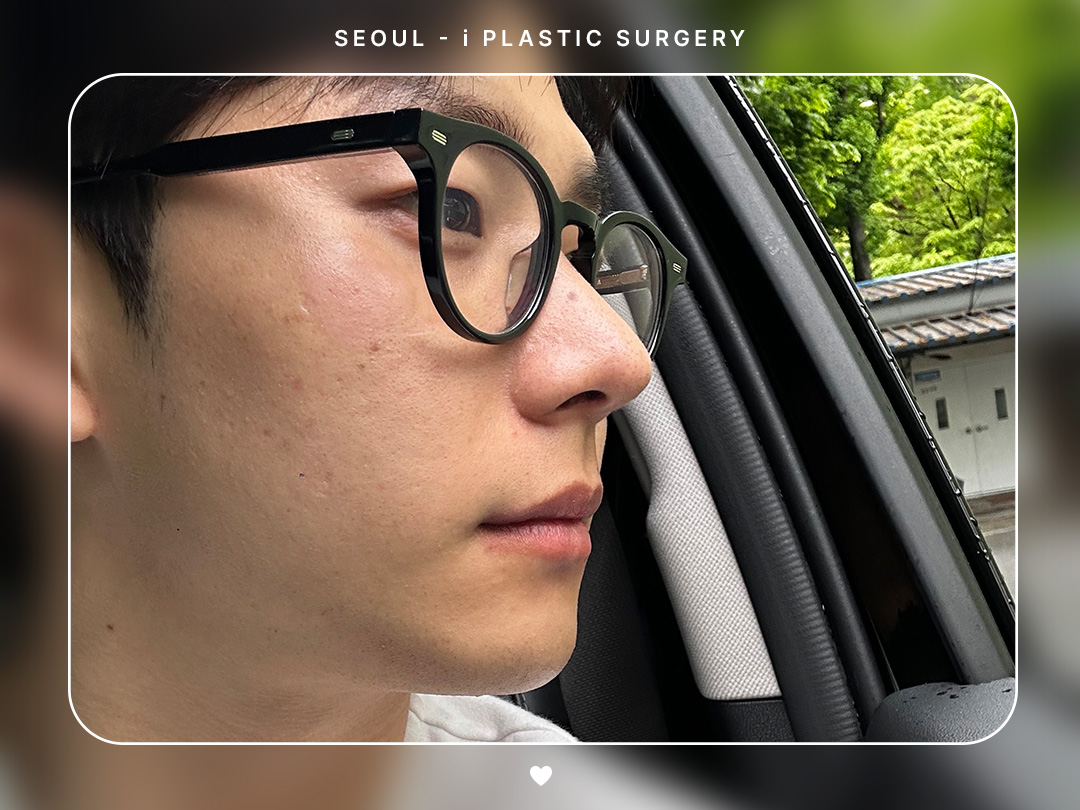 리얼셀카이미지