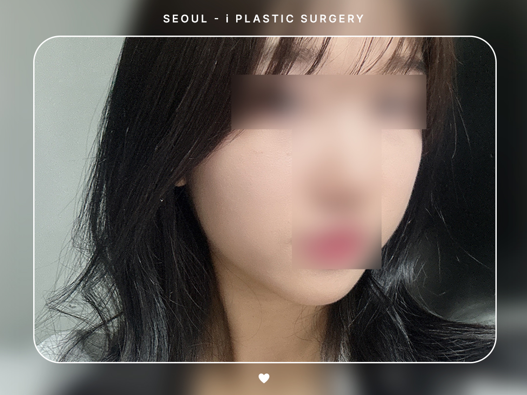 리얼셀카이미지