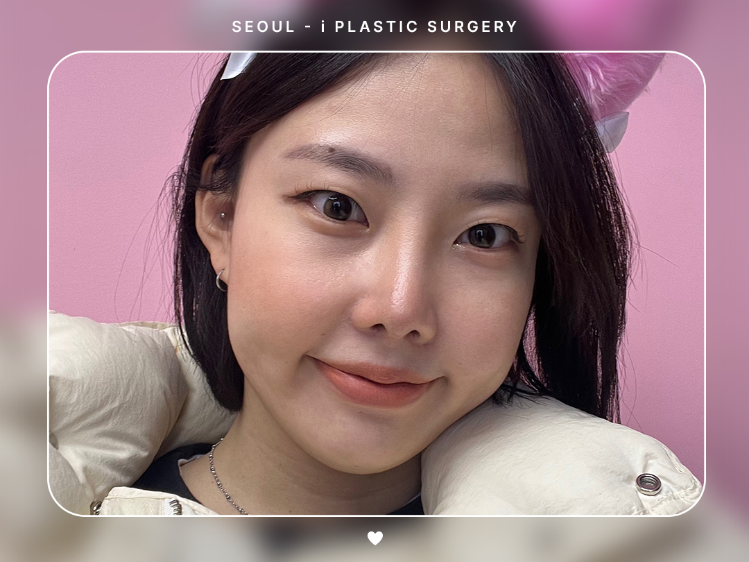 리얼셀카이미지