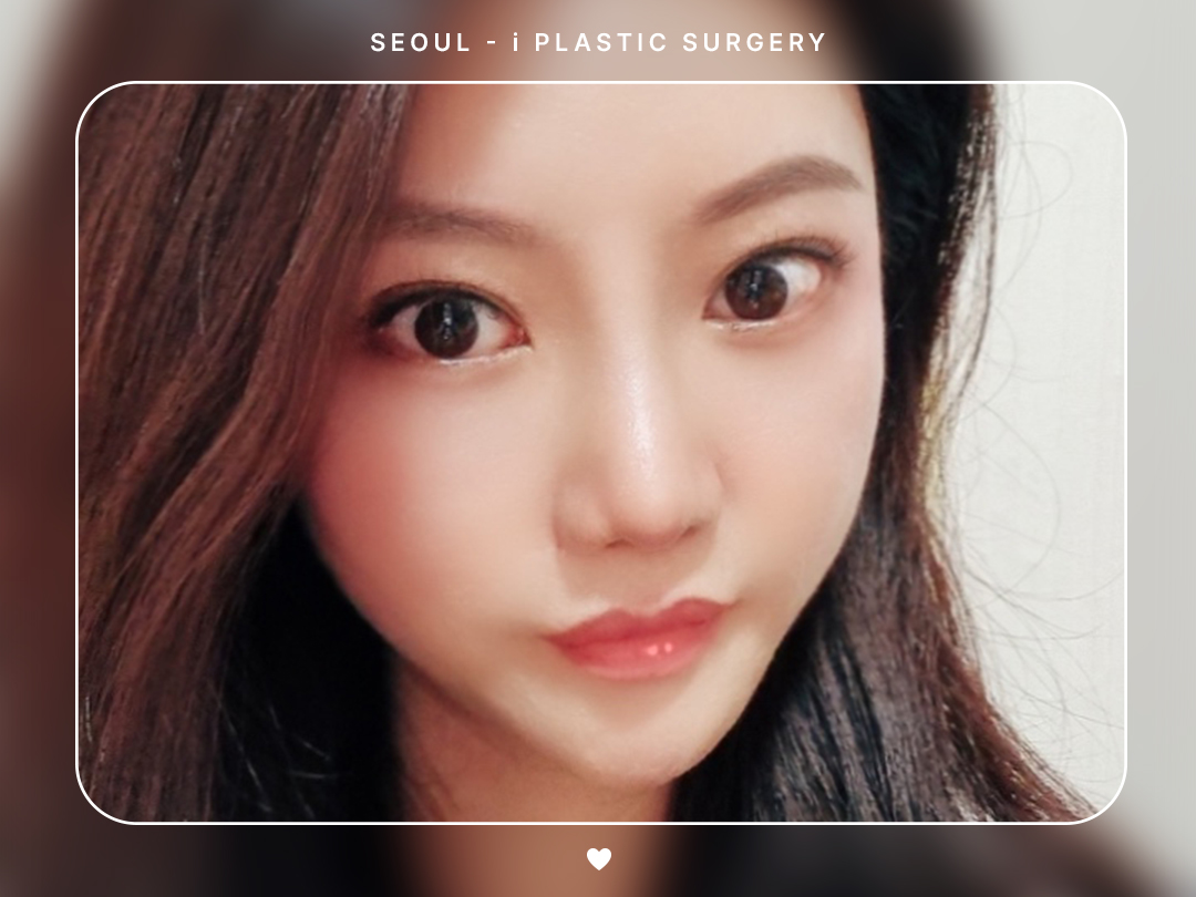 리얼셀카이미지