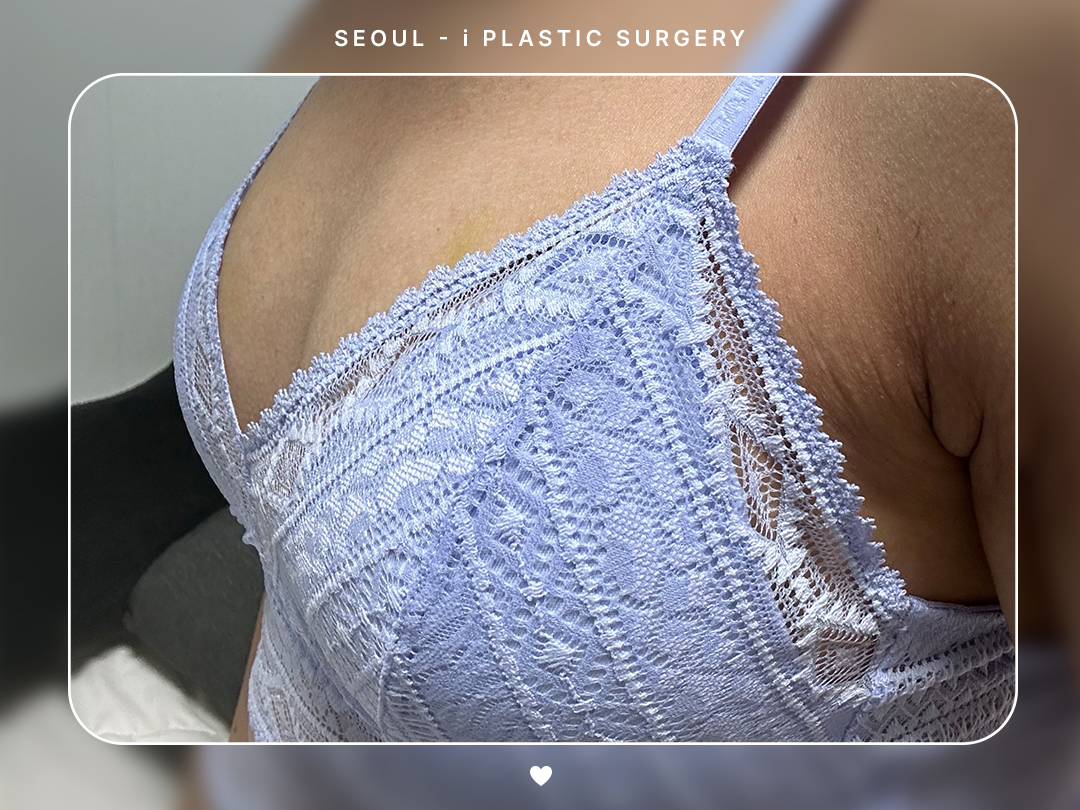리얼셀카이미지
