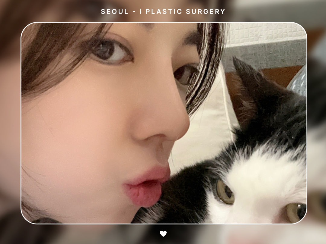 #코끝교정 #복코교정 #매부리코교정