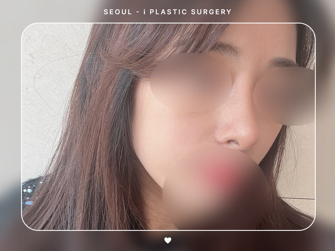 리얼셀카이미지