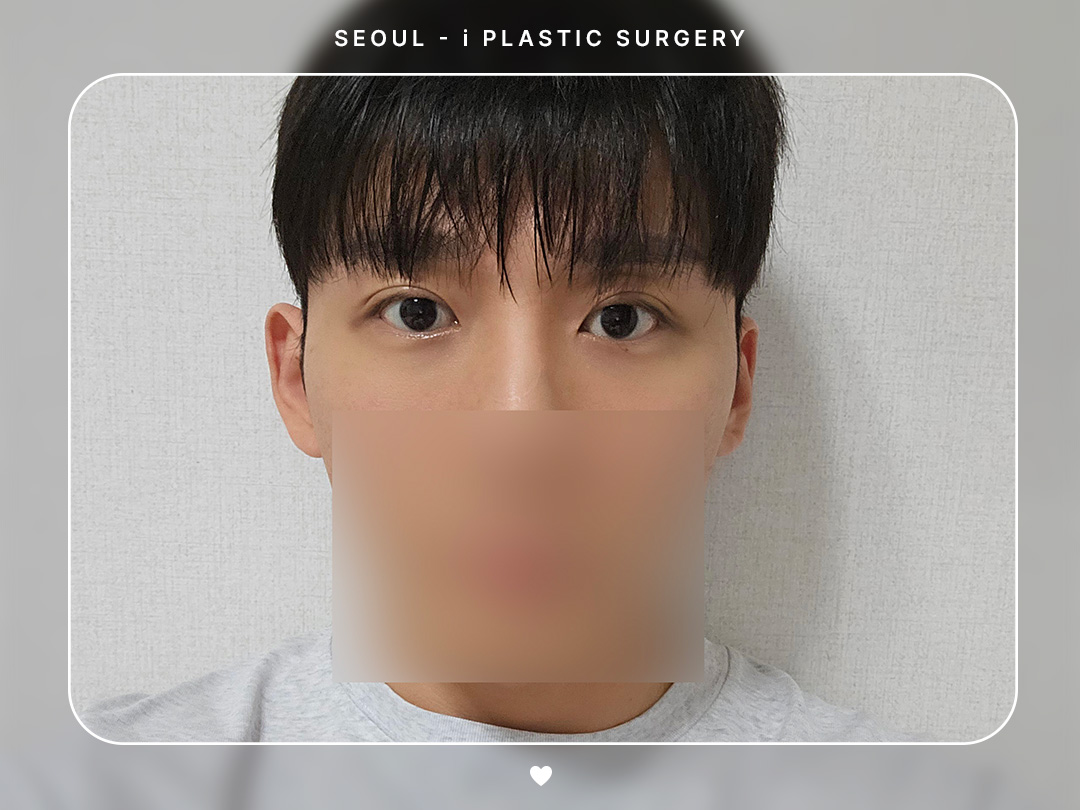 리얼셀카이미지