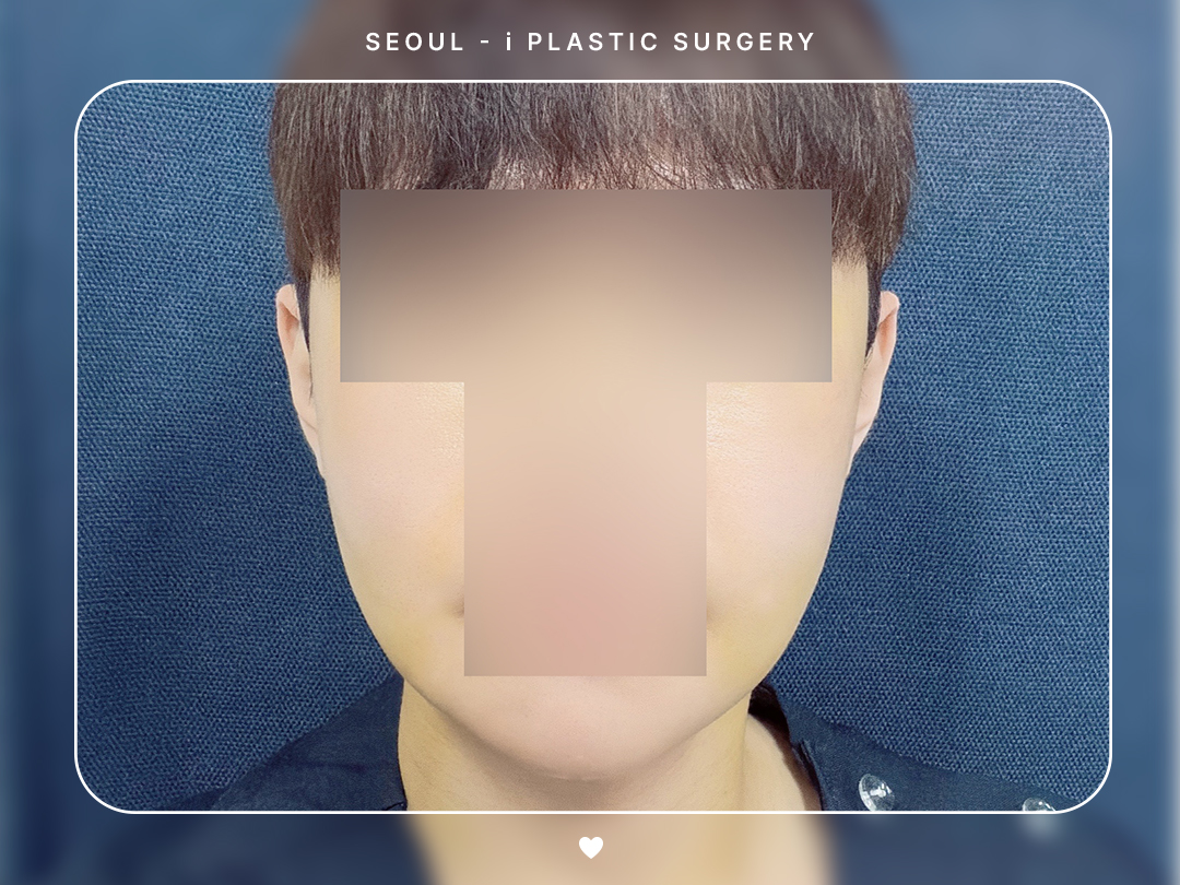 리얼셀카이미지