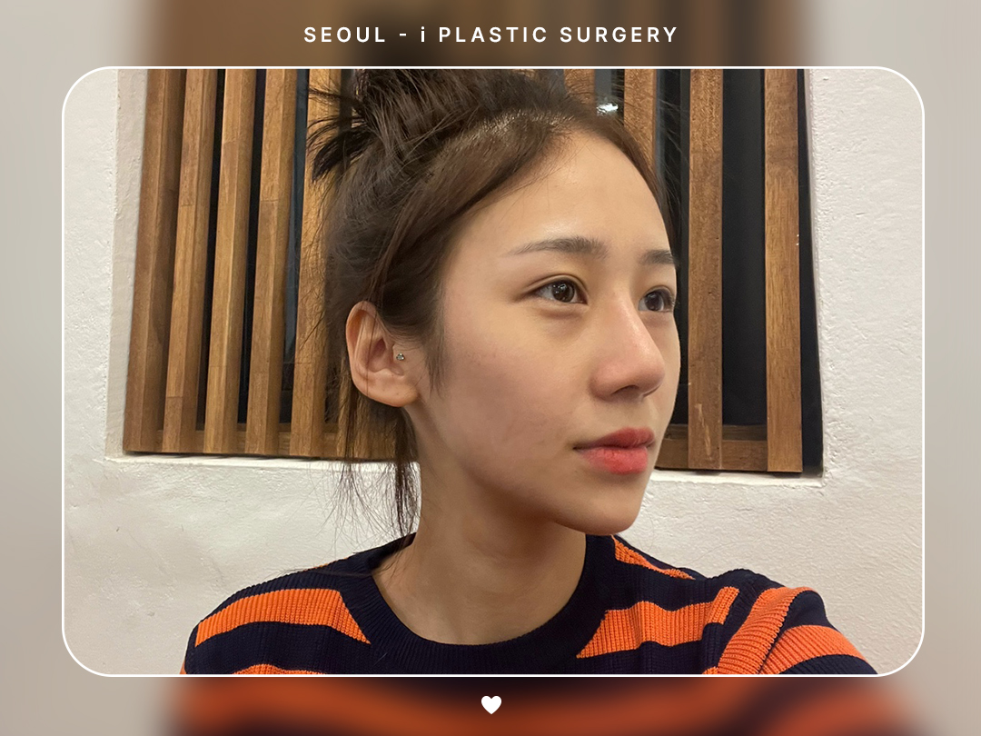 리얼셀카이미지
