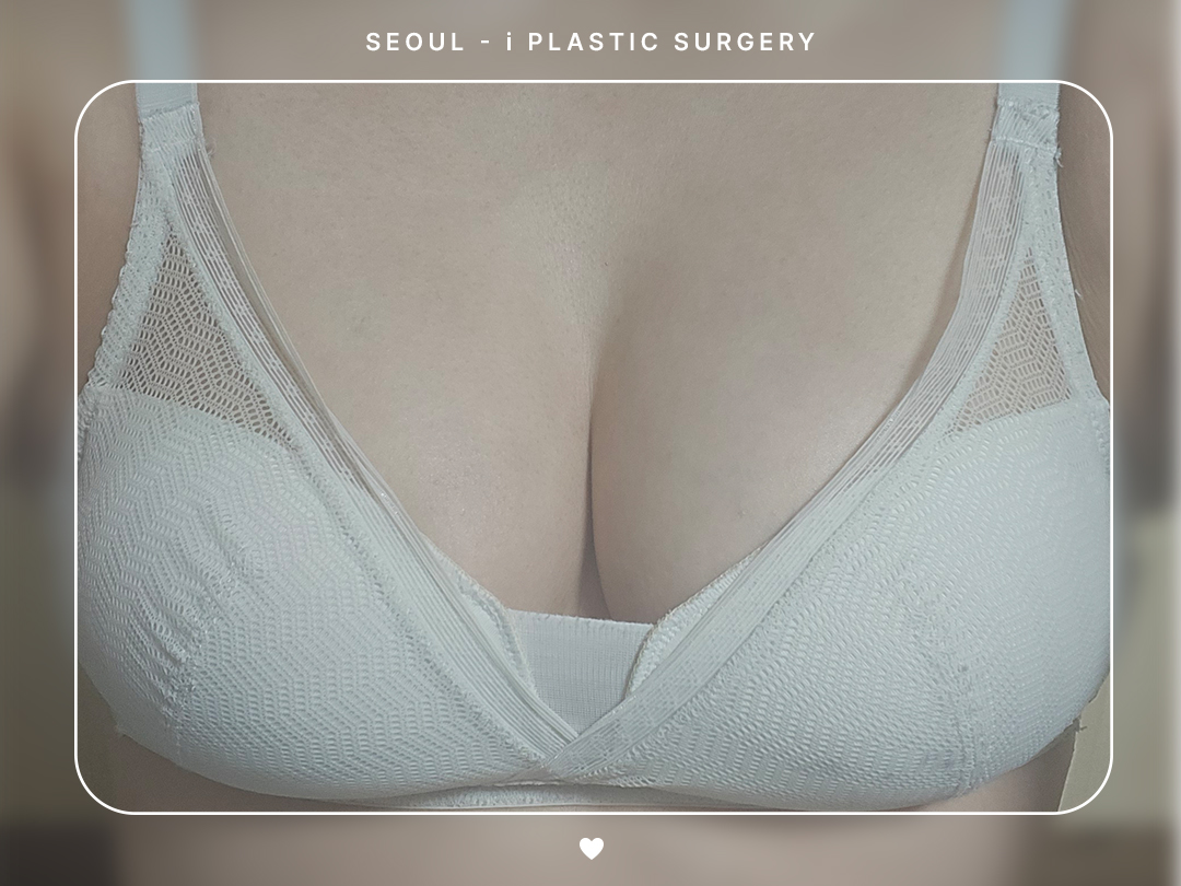 리얼셀카이미지