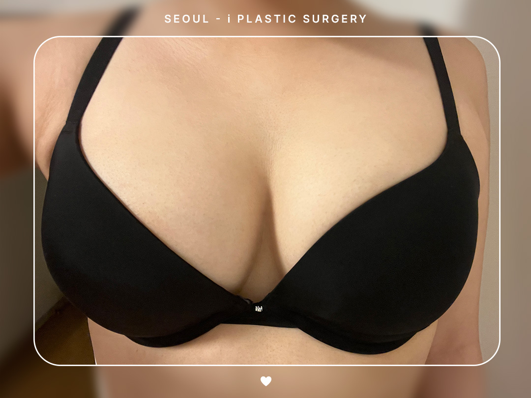 리얼셀카이미지