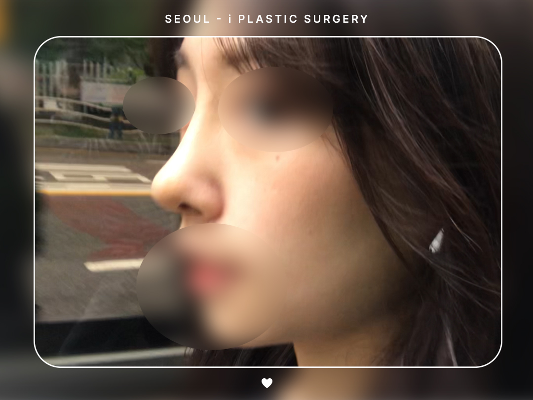 리얼셀카이미지