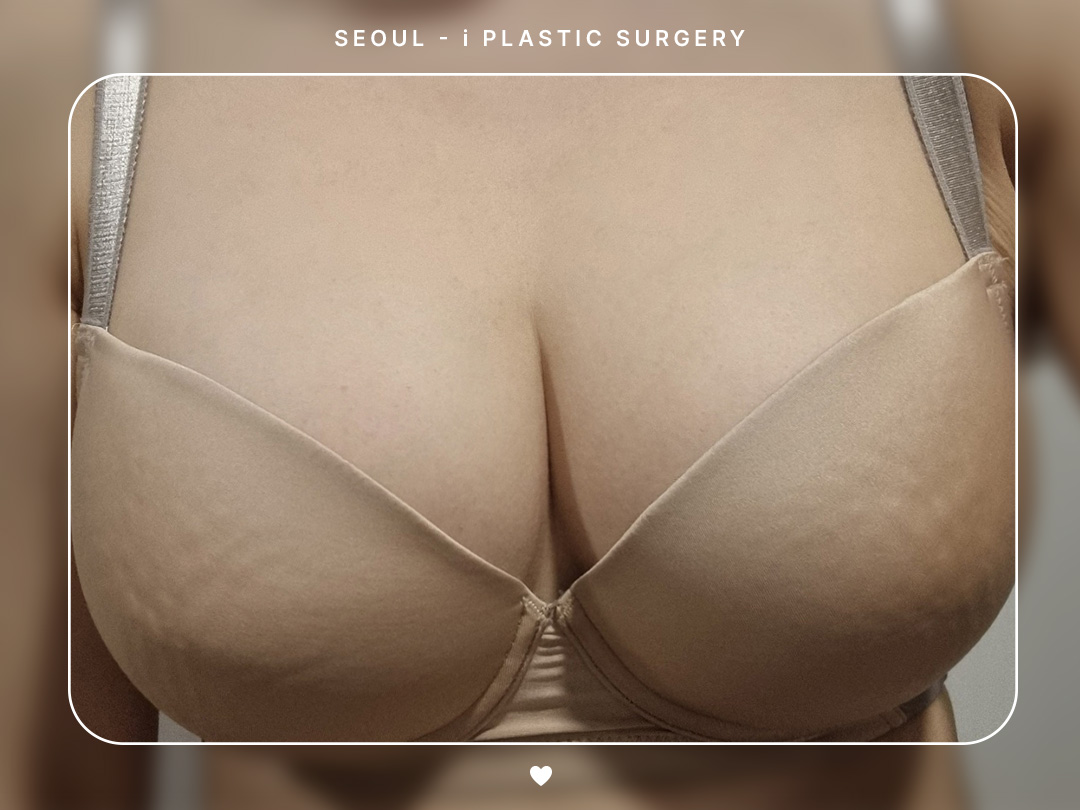 리얼셀카이미지