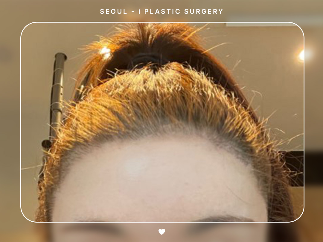 리얼셀카이미지