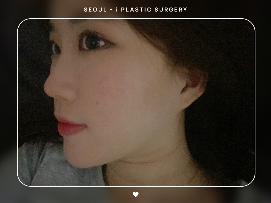 리얼셀카이미지