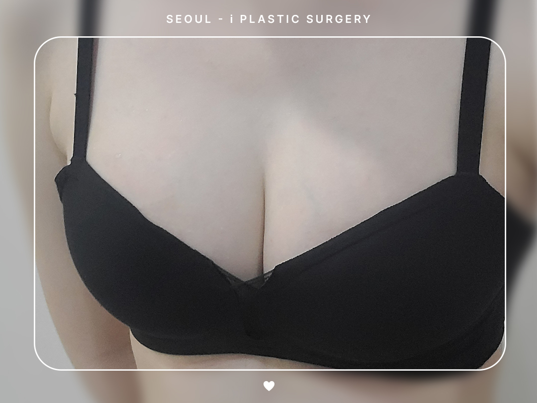 리얼셀카이미지