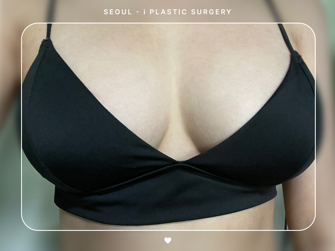 리얼셀카이미지