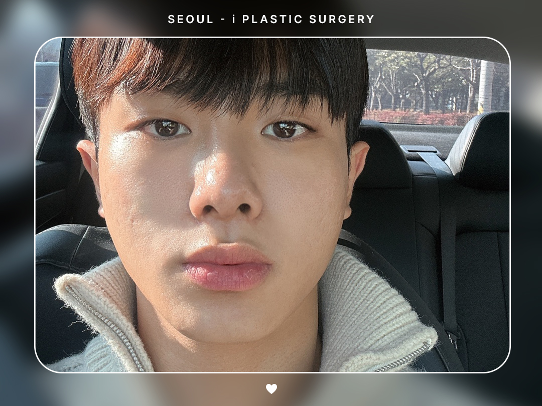 리얼셀카이미지