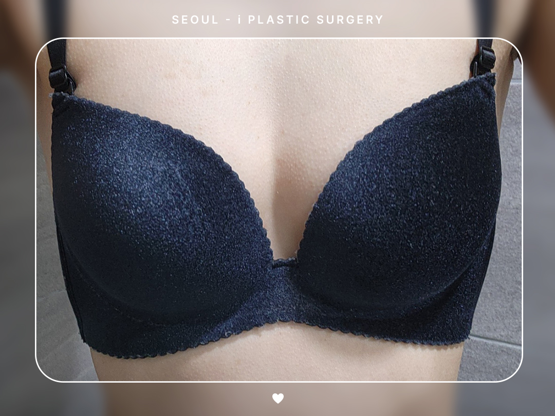 리얼셀카이미지