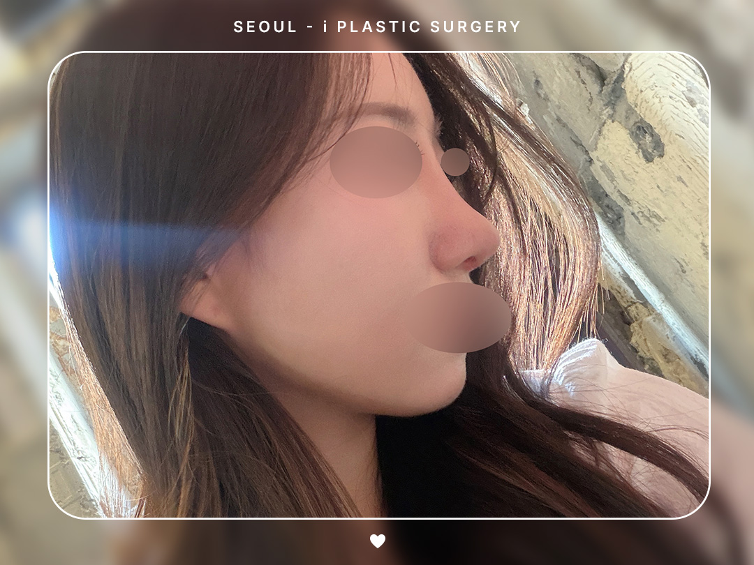 리얼셀카이미지