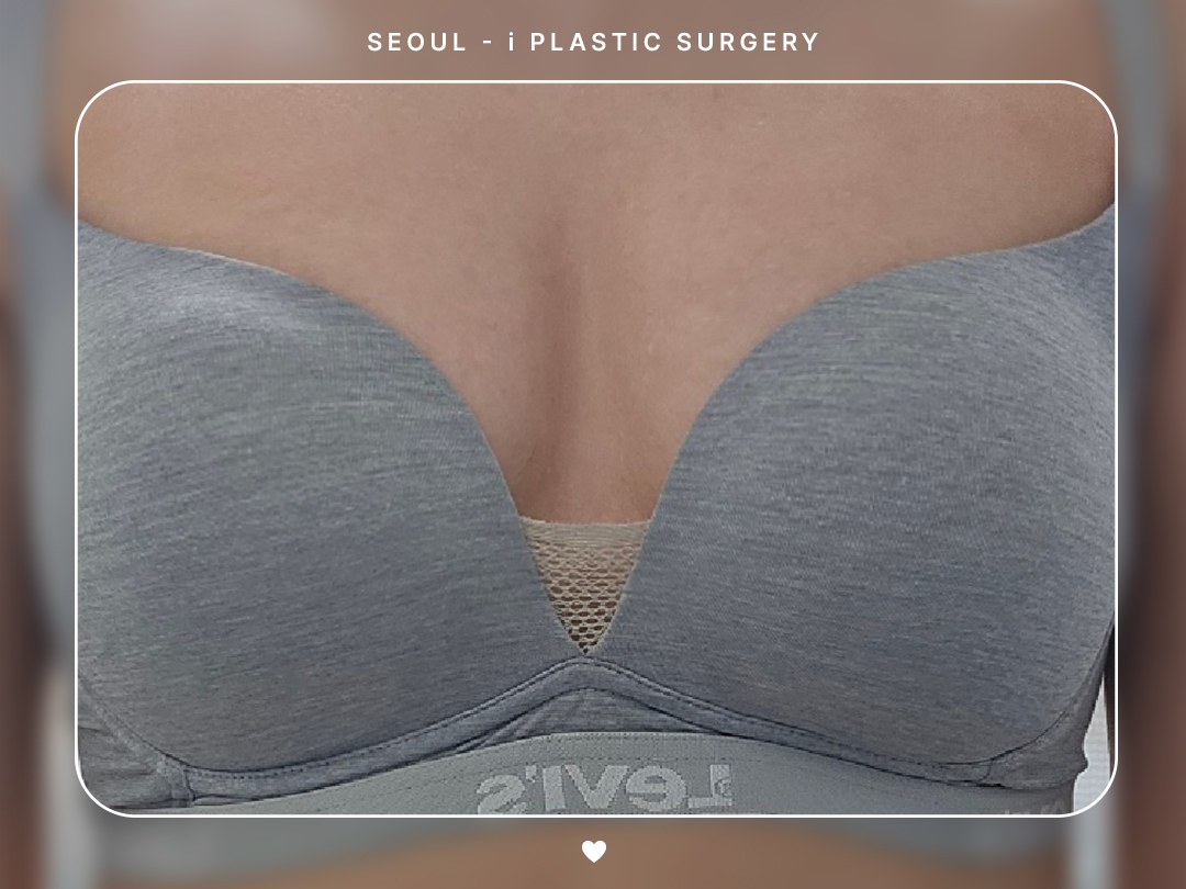 리얼셀카이미지
