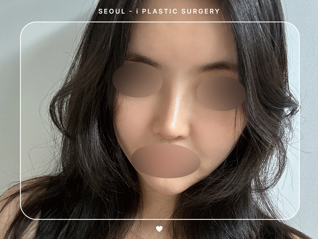 리얼셀카이미지