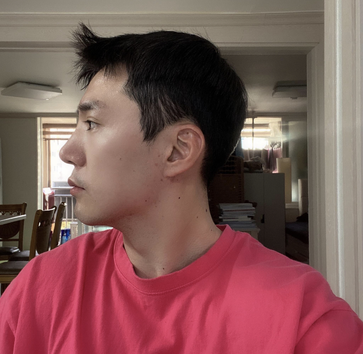 수술후기이미지