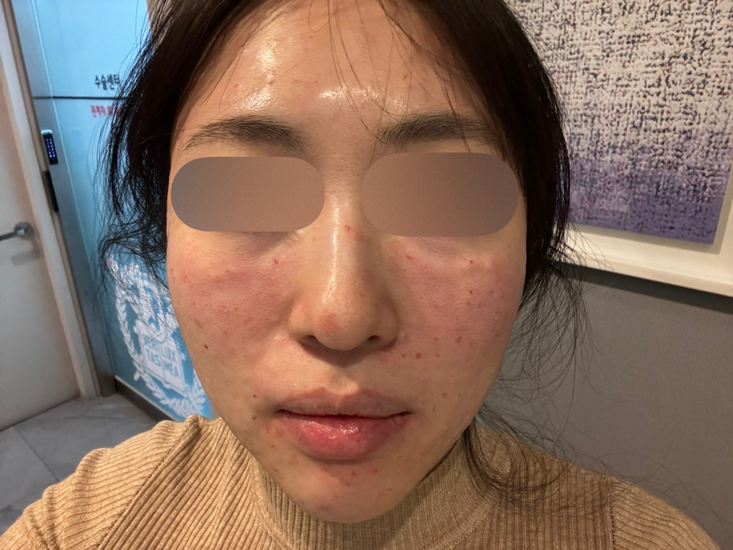 수술후기이미지