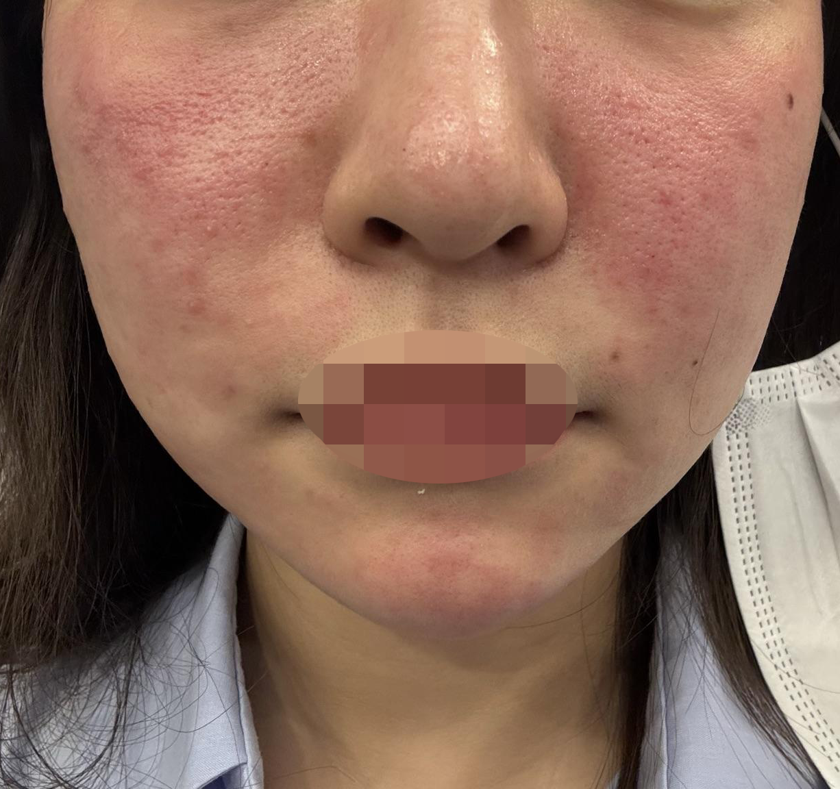 수술후기이미지