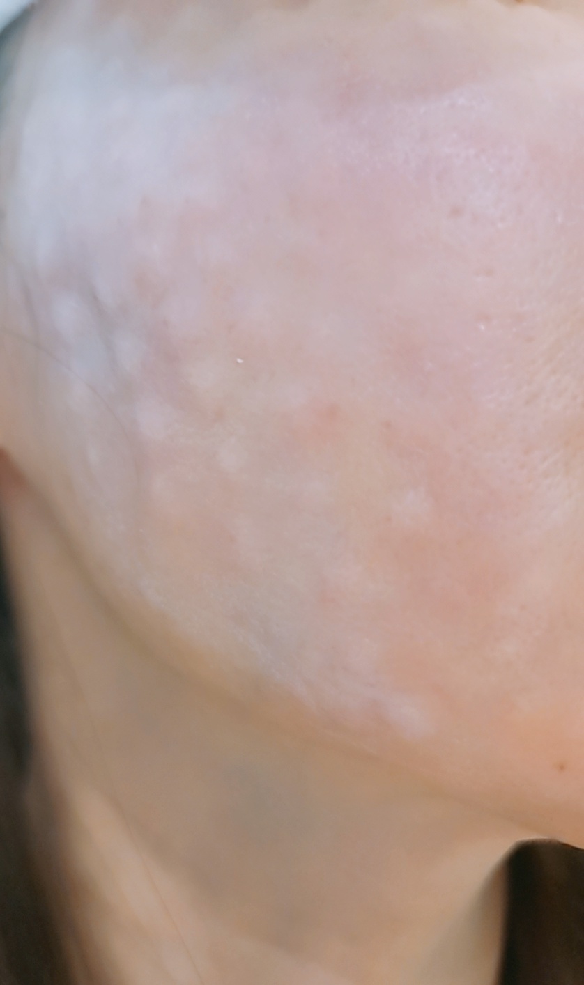 수술후기이미지