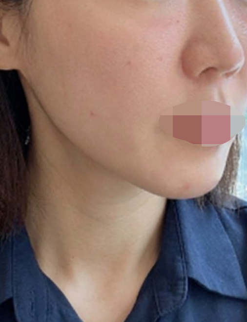 수술후기이미지