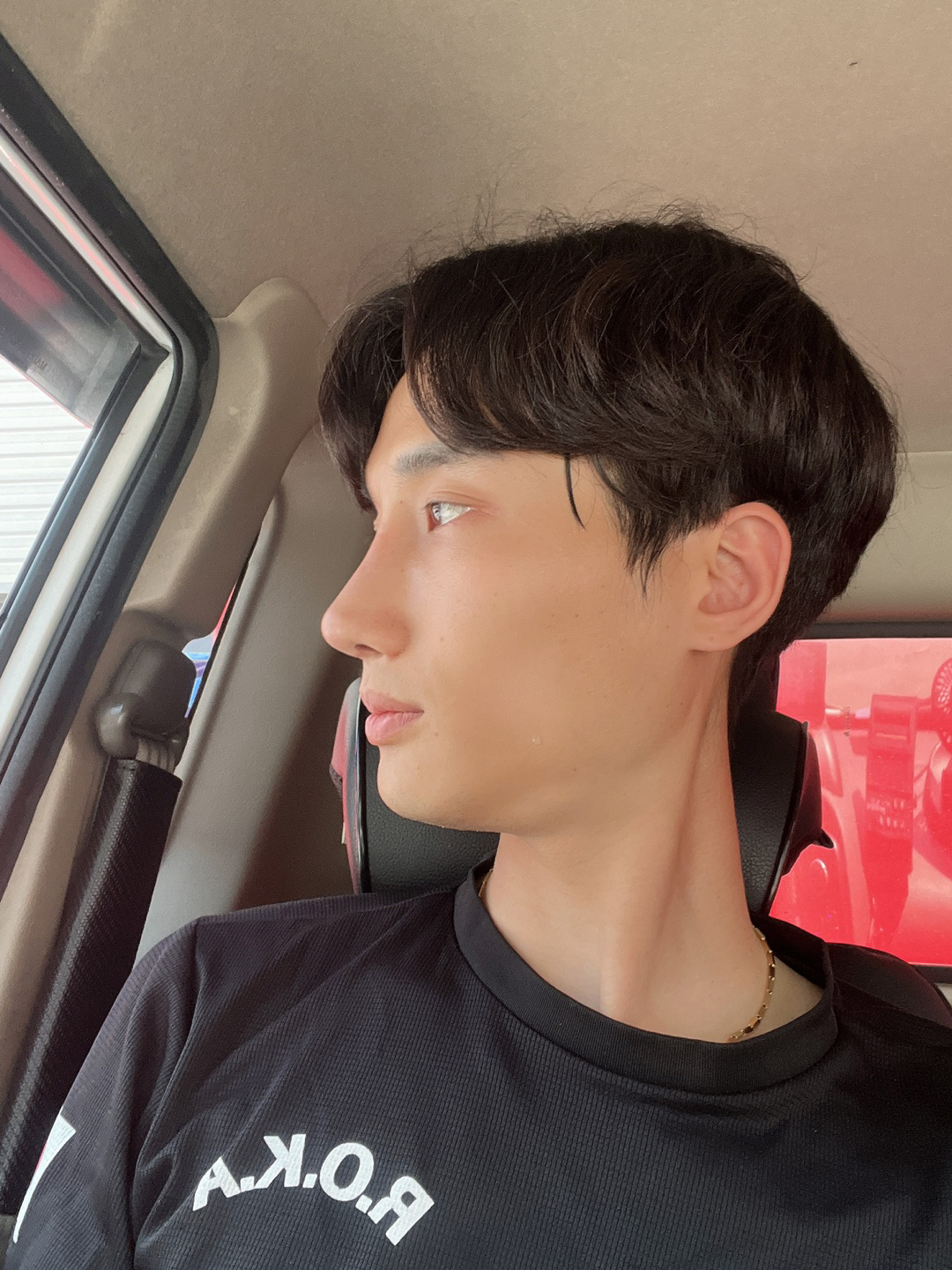 수술후기이미지