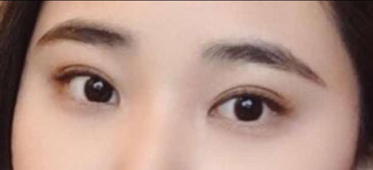 수술후기이미지