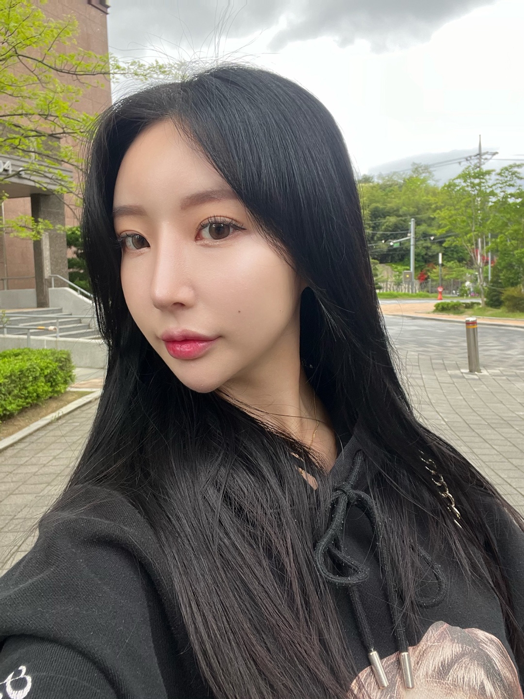 수술후기이미지