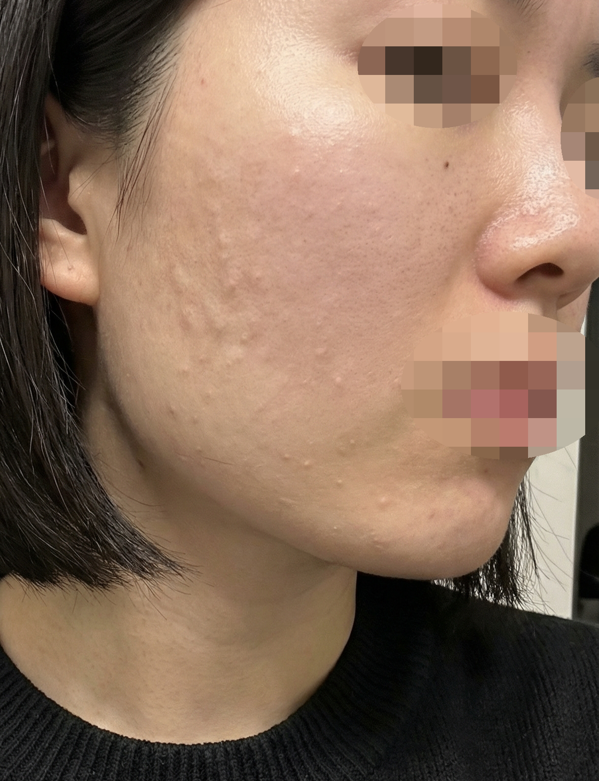 수술후기이미지