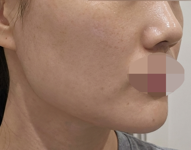 수술후기이미지