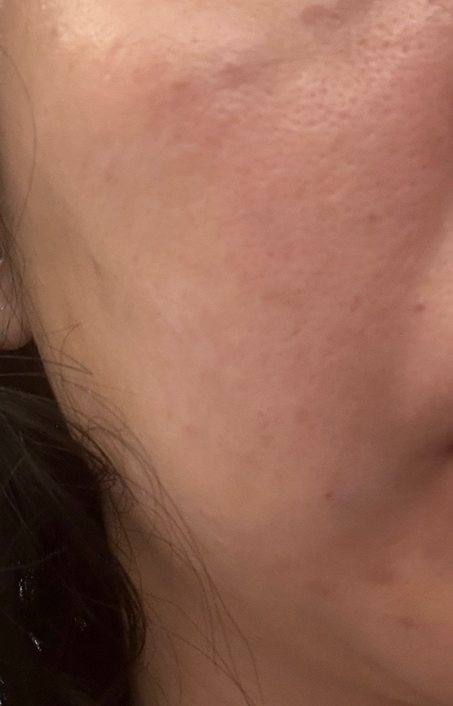 수술후기이미지