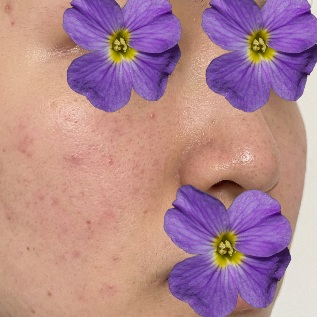 수술후기이미지