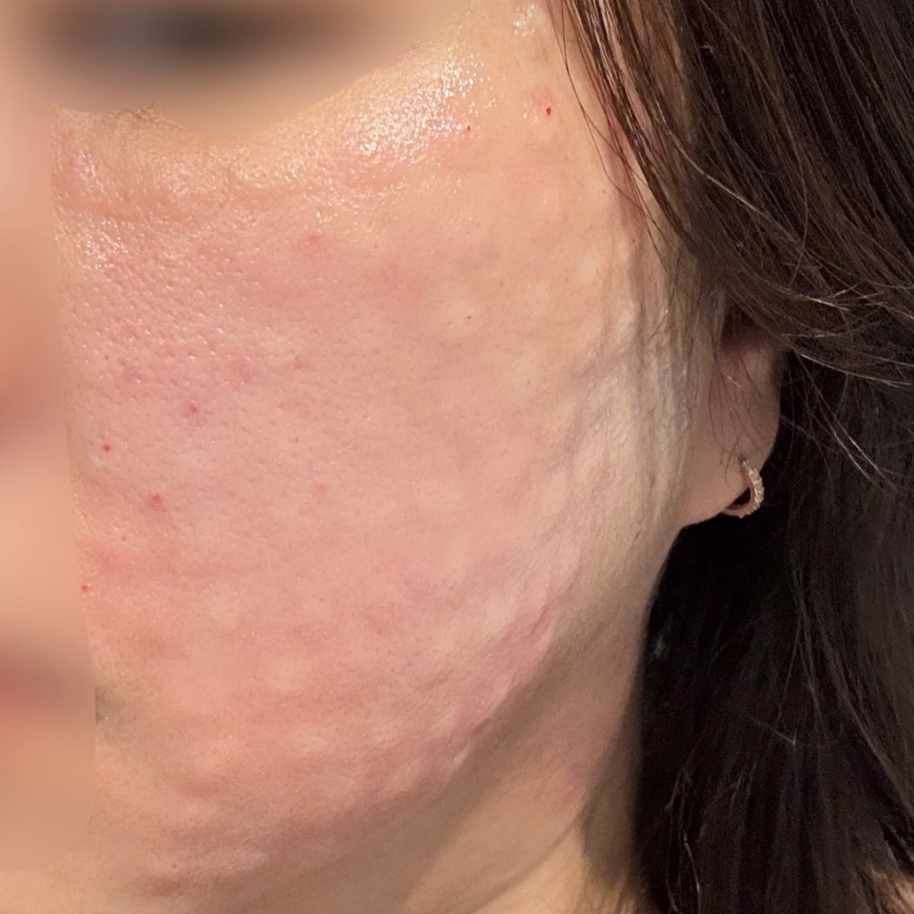 수술후기이미지