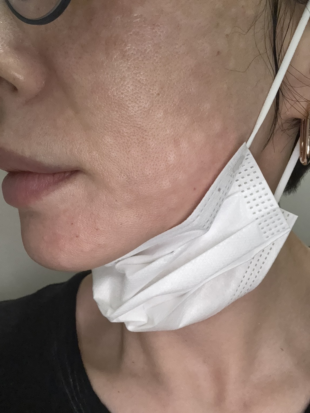 수술후기이미지