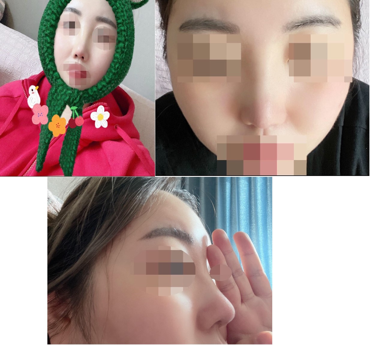 수술후기이미지