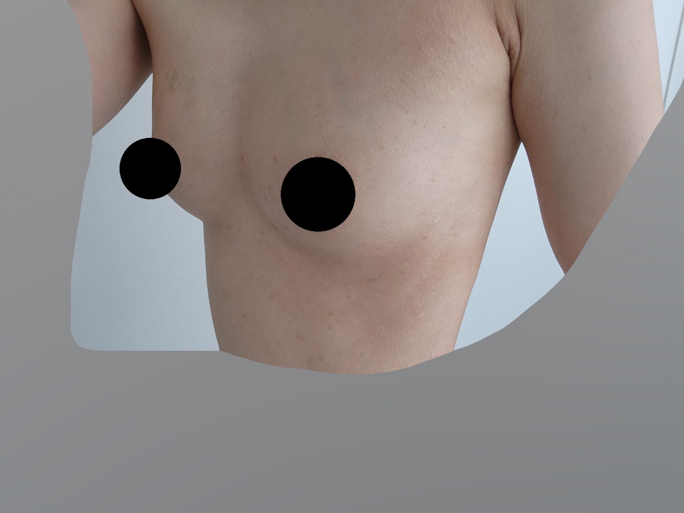 수술후기이미지