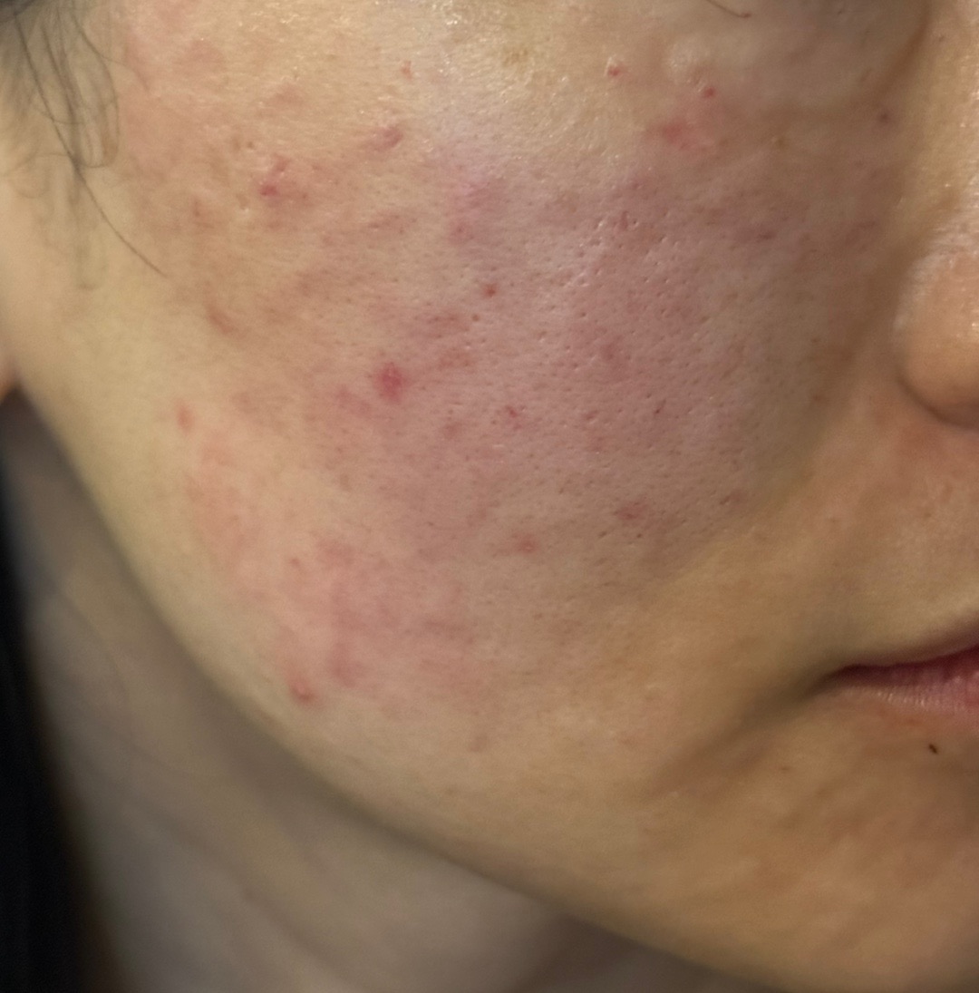 수술후기이미지