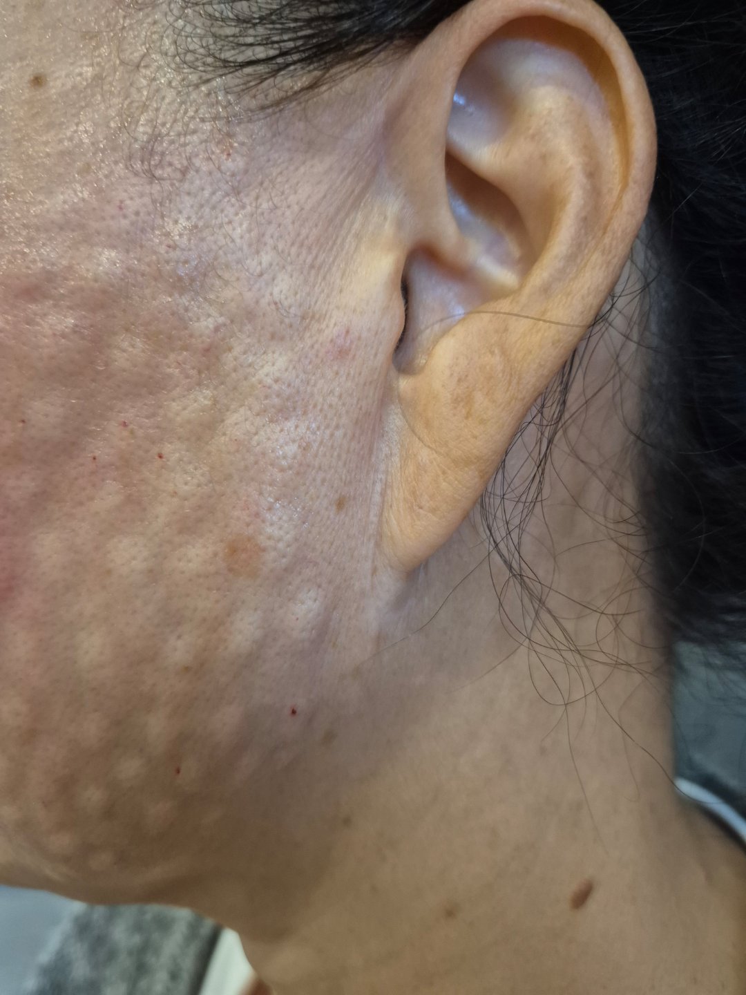 수술후기이미지