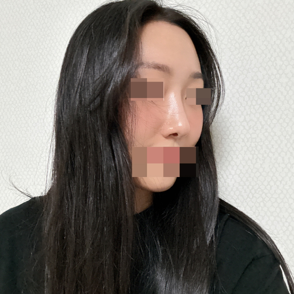 수술후기이미지